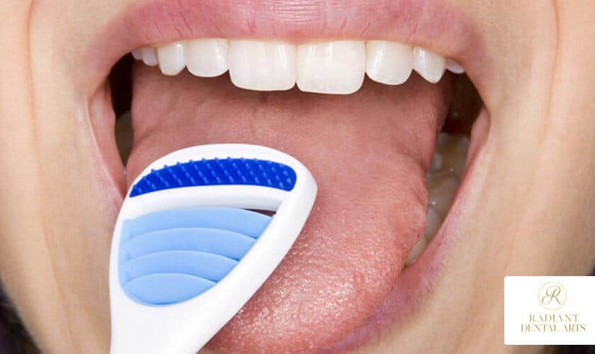 Need-To-Know-About-Tongue-Cleaning-radiant-dental