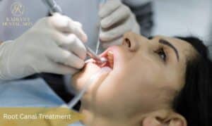 Root Canal Treatment