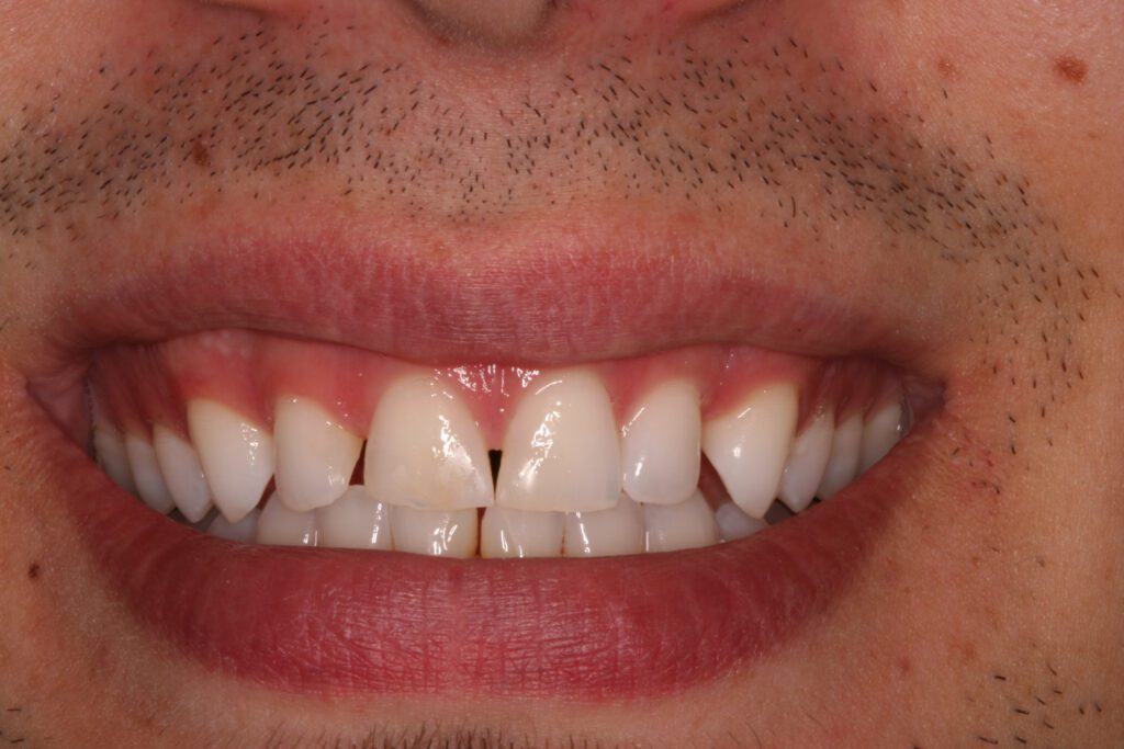 Dentist in San Diego